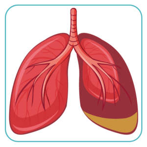 Pulmonology - Lungs
