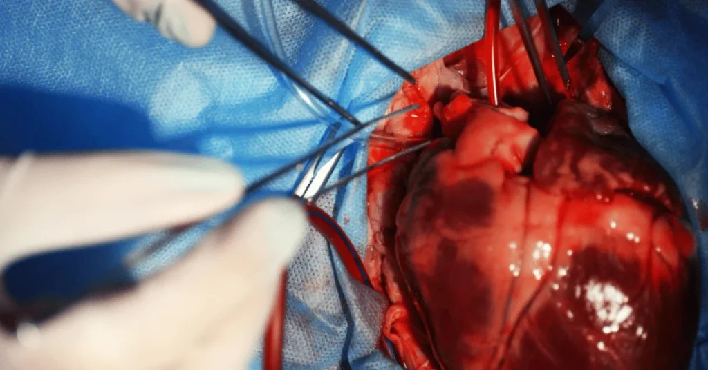 Interventional cardiologist performing balloon valvuloplasty at EPIC Hospital Ahmedabad