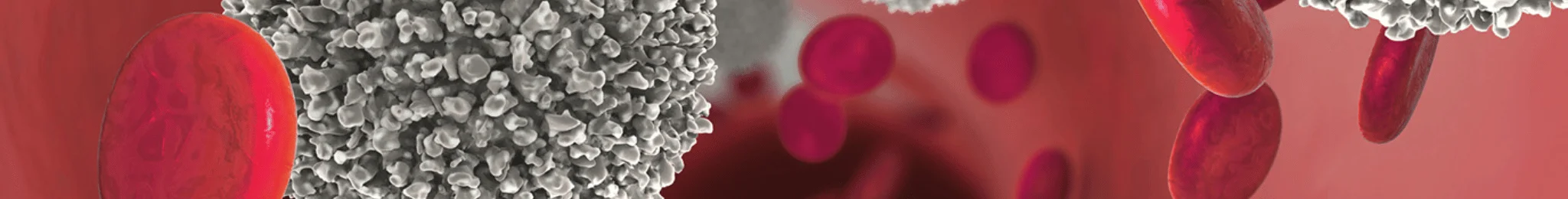 Best Blood Cancer Hospital in Ahmedabad
