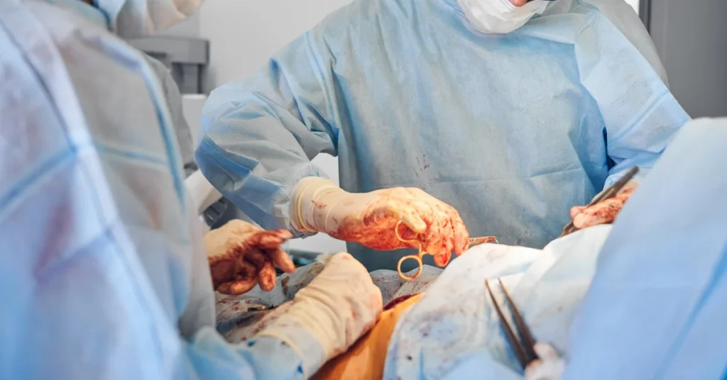 Best CABG surgeon performing coronary bypass at EPIC Multispecialty Hospital Ahmedabad