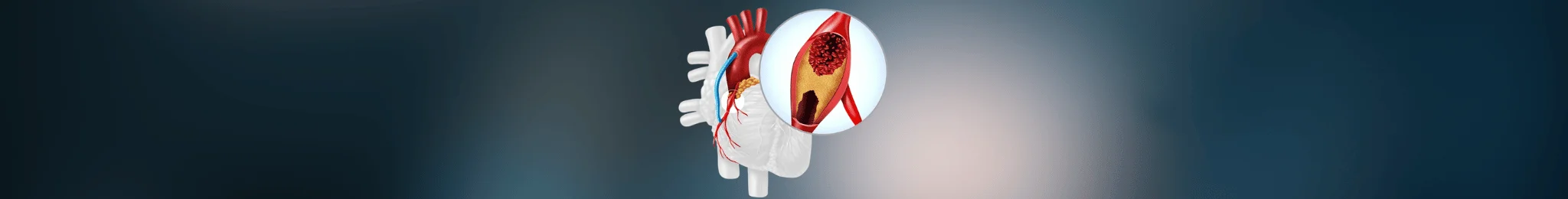 Best Heart Bypass Surgery in Ahmedabad