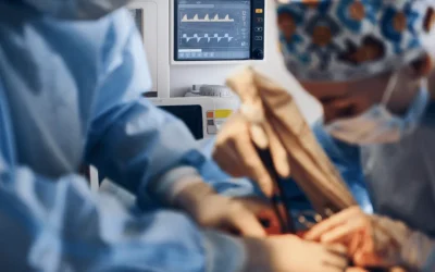 Cardiac surgeon performing bypass surgery at EPIC Hospital, best CABG centre in Ahmedabad Gujarat
