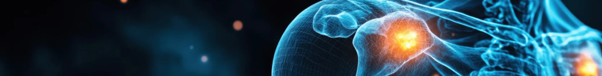 Best Shoulder Replacement Surgery in Ahmedabad