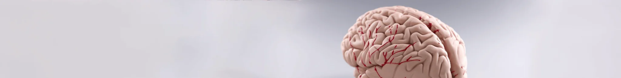 Brain Stroke Treatment in Ahmedabad