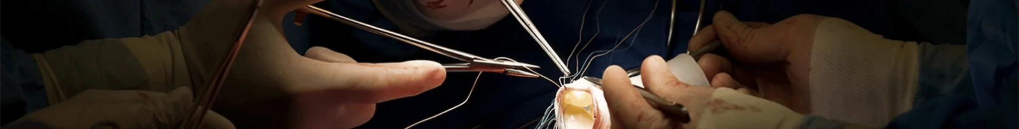 Cardiovascular & Thoracic Surgeon in Ahmedabad