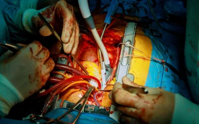 Cardiovascular and thoracic surgeon at EPIC Multispecialty Hospital Ahmedabad reviewing chest imaging