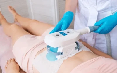Interventional pulmonologist preparing cryotherapy equipment at EPIC Hospital Ahmedabad