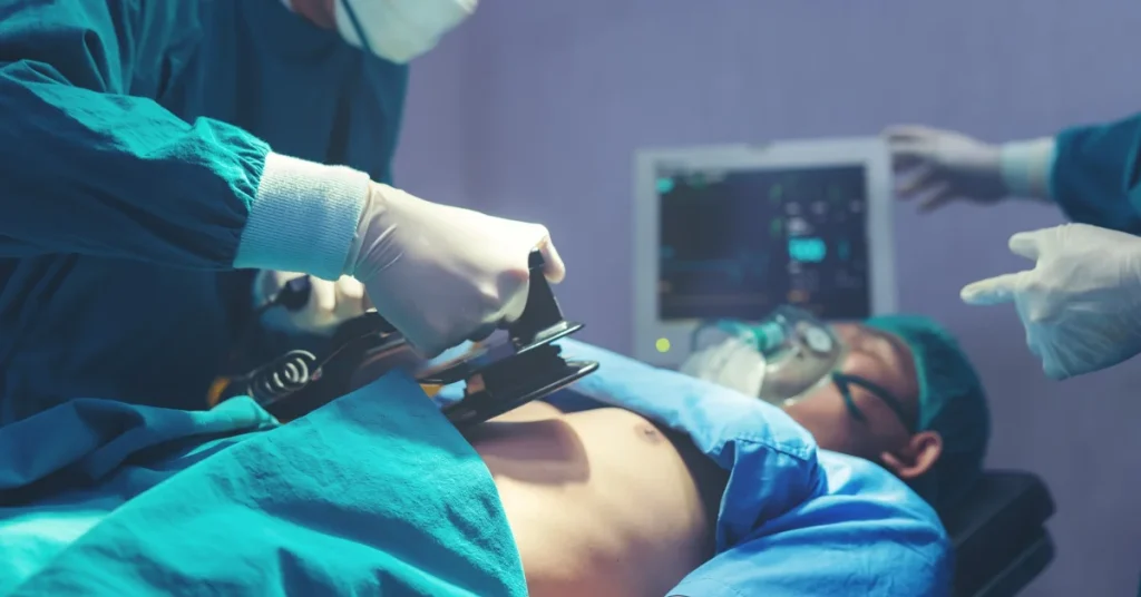 Cardiologist performing emergency heart attack treatment surgery at EPIC Hospital Ahmedabad