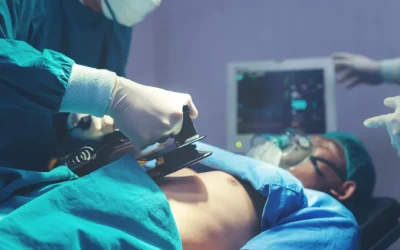 Cardiologist performing emergency heart attack treatment surgery at EPIC Hospital Ahmedabad