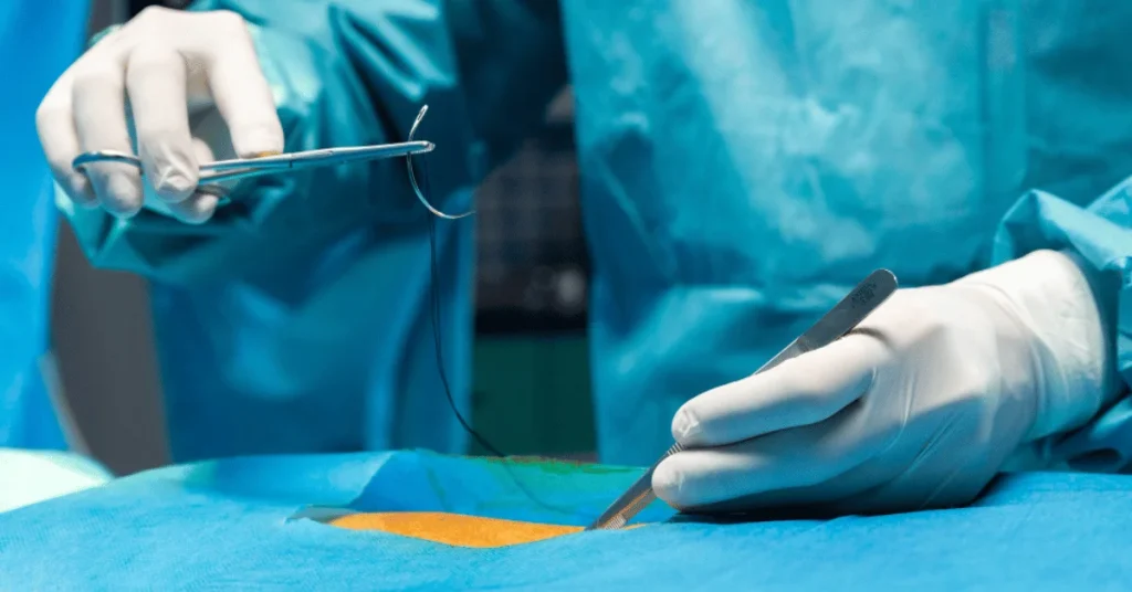 Cardiac surgeon performing LIMA BIMA arterial grafting during bypass surgery at EPIC Hospital Ahmedabad