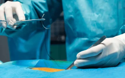 Cardiac surgeon performing LIMA BIMA arterial grafting during bypass surgery at EPIC Hospital Ahmedabad
