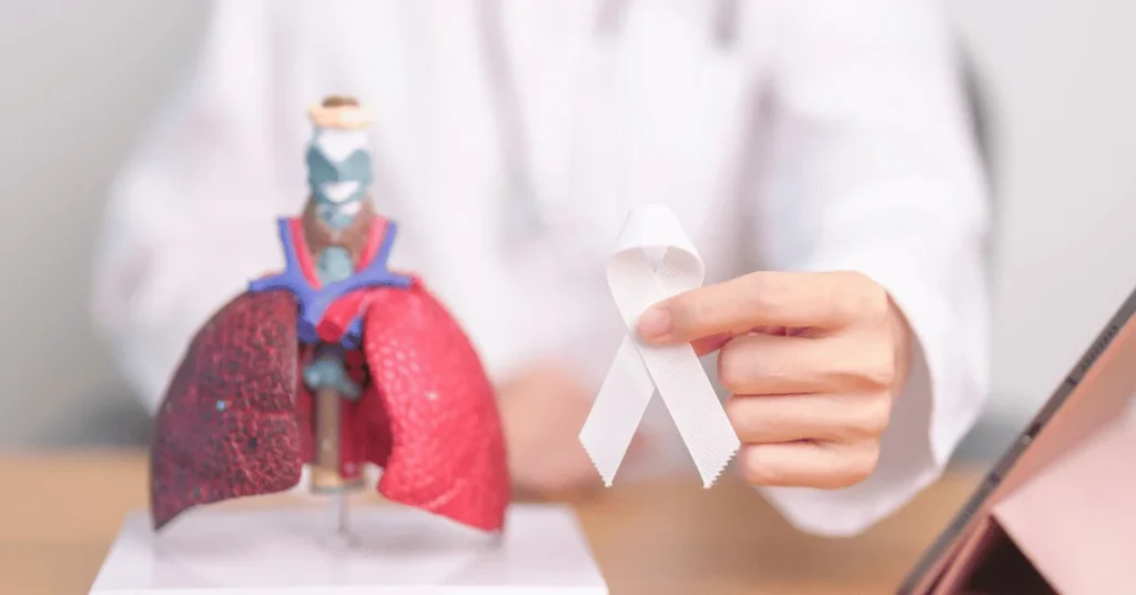 Specialist reviewing a lung scan for early signs of lung cancer at EPIC Hospital Ahmedabad