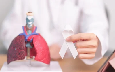 Specialist reviewing a lung scan for early signs of lung cancer at EPIC Hospital Ahmedabad