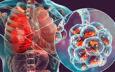 Pulmonologist examining a patient with a lung infection at EPIC Hospital Ahmedabad