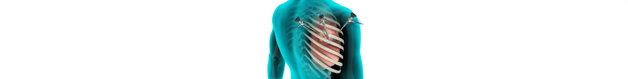 Minimally Invasive Cancer Surgery in Ahmedabad