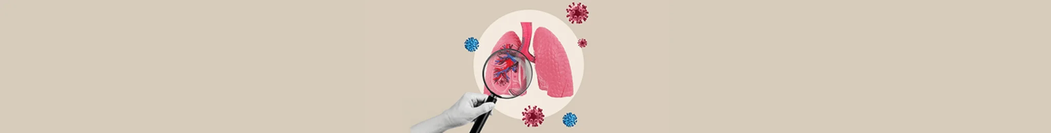 Pulmonary Infection Treatment in Ahmedabad