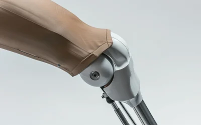 Robotic-assisted knee replacement technology at EPIC Hospital Ahmedabad