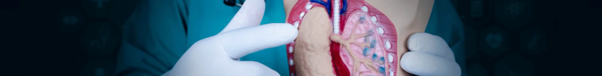 TAVI Treatment in Ahmedabad