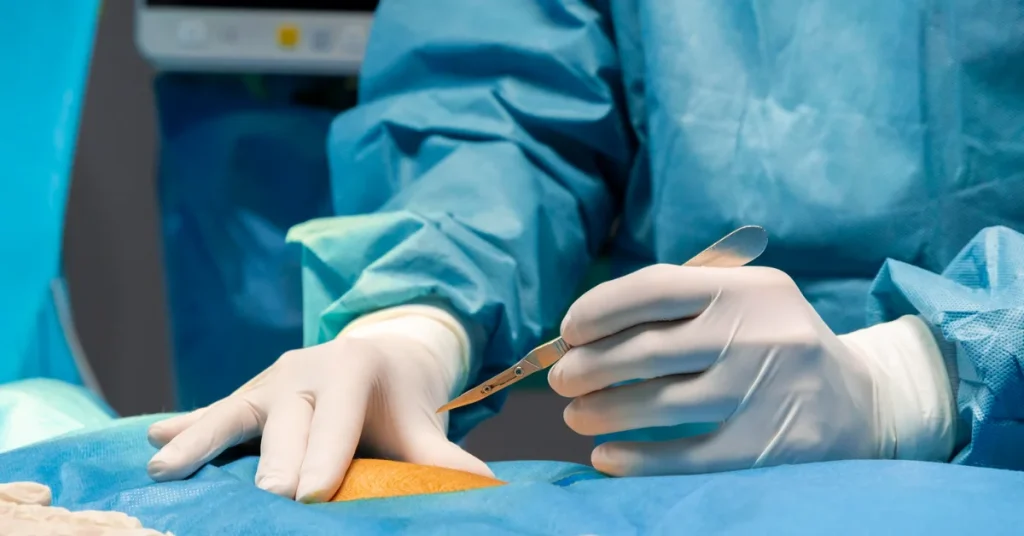 Vascular surgery team at EPIC, a leading vascular surgery hospital in Ahmedabad Gujarat