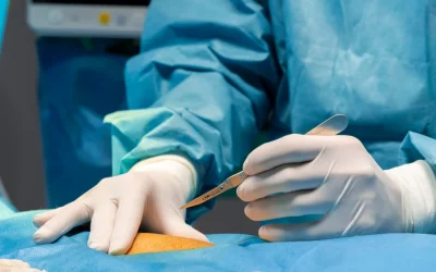 Vascular surgery team at EPIC, a leading vascular surgery hospital in Ahmedabad Gujarat