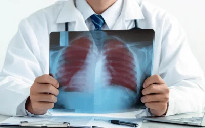 Chest physician listening to a patient's chest at EPIC Hospital Ahmedabad