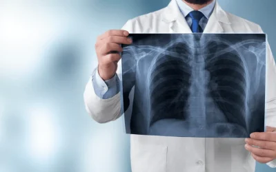 Pulmonology care team at EPIC Hospital Ahmedabad Gujarat